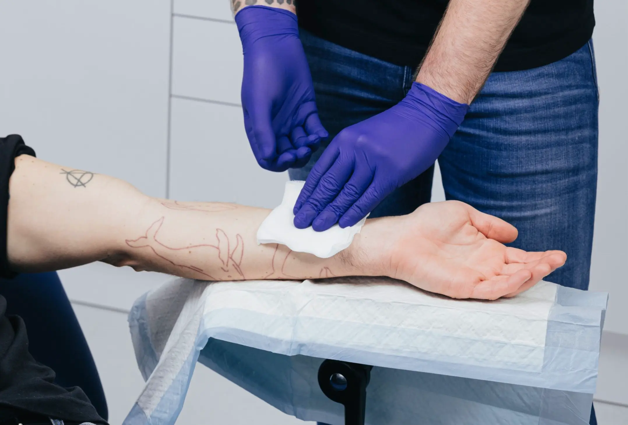 Versorgung der Wunde mit Handschuhen.